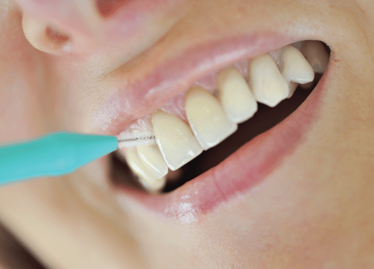 How To Clean In Between Teeth?