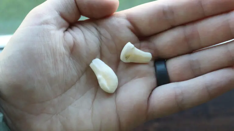 How To Clean Elk Teeth?