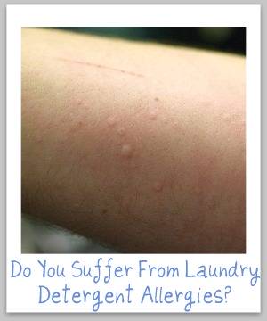 Can You Be Allergic To Laundry Detergent?