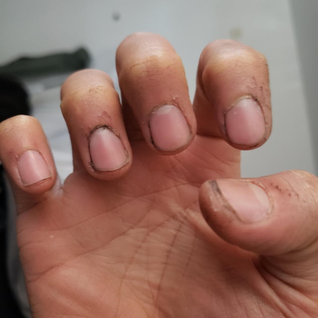 How to Clean Mechanic Nails?